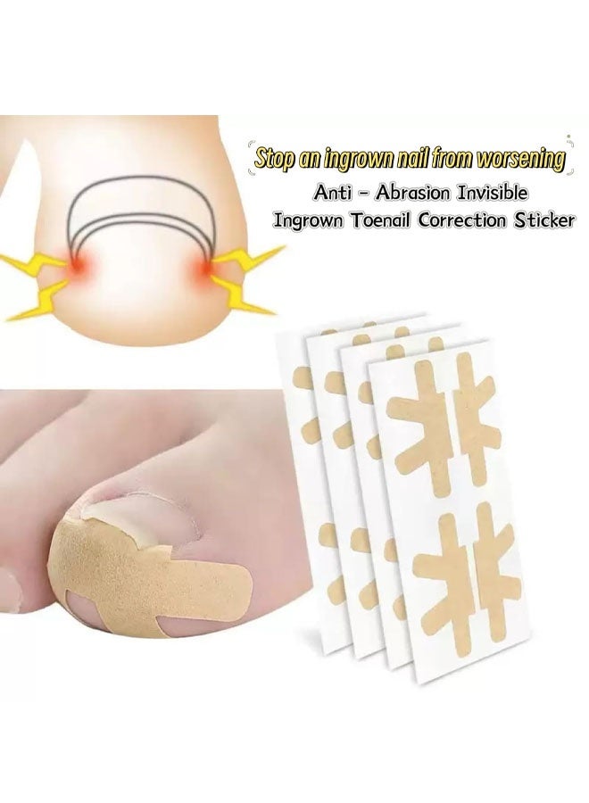 ٢٠ قطعة لعلاج الأظافر الناشبة، شرائط مسامية للأظافر الناشبة، أداة غير مؤلمة لإزالة الأظافر الناشبة والعناية بها، حل للعناية بالقدمين في المنزل - Image 4